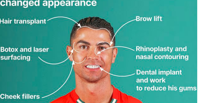 شاهد...جراح تجميل يكشف أسرار تغير ملامح رونالدو خلال 20 عاما!
